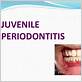 juvenile gum disease