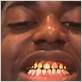 kodak black gum disease