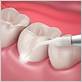 laser dental surgery gum disease