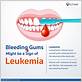 leukemia and gum disease