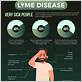 lyme disease and gum pain