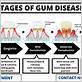 management of gum disease