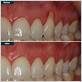 manhattan periodontal gum disease