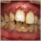 marylebone gum disease