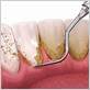 marysville gum disease treatment