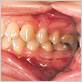 mayo clinic gum disease