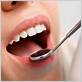 more evidence links gum disease to stroke risk