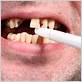 nicotine gum and periodontal disease