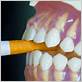 nicotine replacement and gum disease