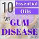 oils for gum disease