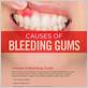 oral bleeding causes