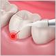 oralmax gum disease treatment review