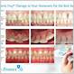 oram plus gum disease treatment