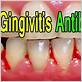over the counter meds for gingivitis