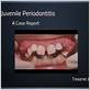 perienamel juvenile gum disease