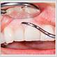 periodontal/gum disease san diego