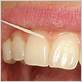 periodontal disease and dental floss