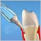 periodontal disease treatment waterpik