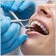 periodontal gum disease grand prairie