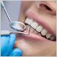 periodontal gum disease houston tx