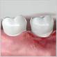 periodontal gum disease lexington