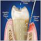 periodontal gum disease maintenance