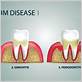periodontal gum disease treatment auburn me