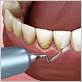 periodontal gum disease treatment near me