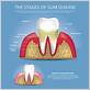 periodontal gum disease waco