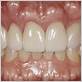 periodontics gum disease treatments in las vegas ecsept medicaid