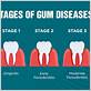 peritonitis gum disease