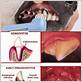 peroxide aloe dog gum disease