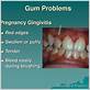 pregnancy gum problems