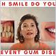 prevent cavities gum disease