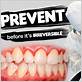 prevent gum disease northern suffolk