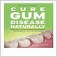 ramiel nagel cure gum disease free download
