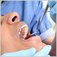 rancho santa margarita gum disease treatment