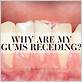 receeding gums periodontist no gum disease