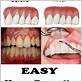 remedy for ed caused by gum disease