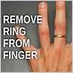 remove rings off swollen knuckle with dental floss
