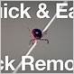 removing a tick with dental floss