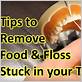 removing dental floss stuck between teeth