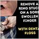 ring stuck swollen finger dental floss