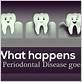 risks of untreated gum disease