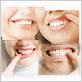 rochester mn gum disease dentist