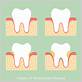 salinas gum disease treatments