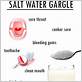 salt water gargles for gum disease