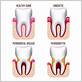 sammamish gum disease prevention and maintenance