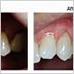 santa cruz gum disease treatments