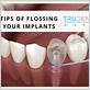 should you floss above your dental implant crown